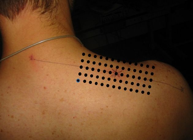 Electrode positioning